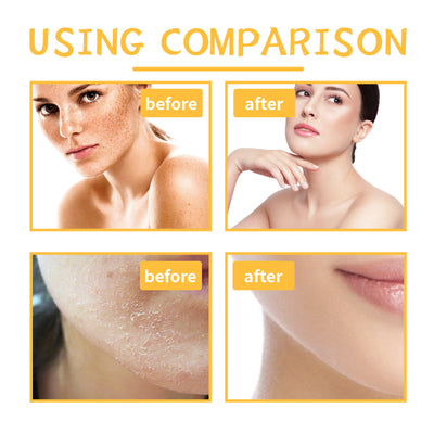 EELHOE Turmeric Body Scrub Cream Skin Cleaning Cutin